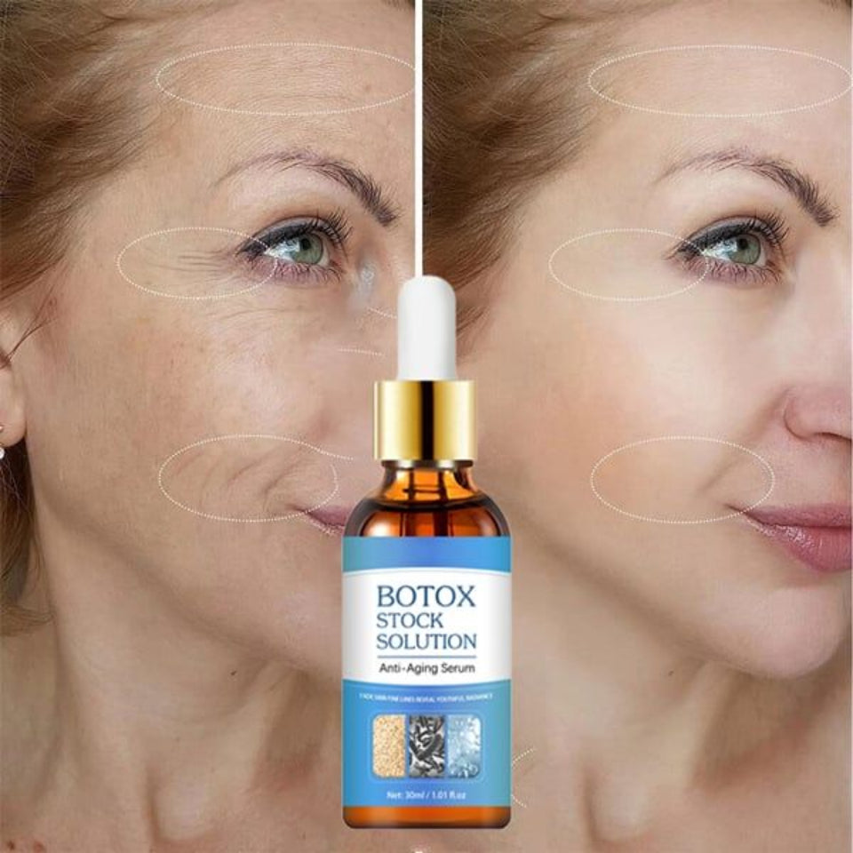 Botox Stock Solution