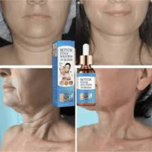 Botox Stock Solution