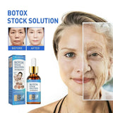 Botox Stock Solution